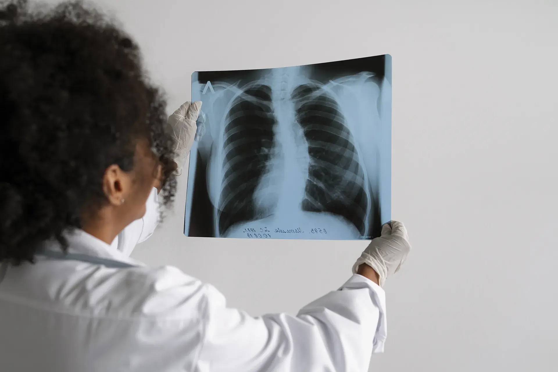 Mesothelioma diagnosis.